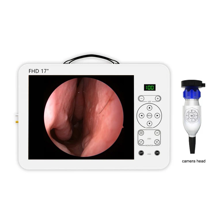 17 İnç HD Video Otoskop KBB Te - Medical Lab Images incelemesi ve fiyatı